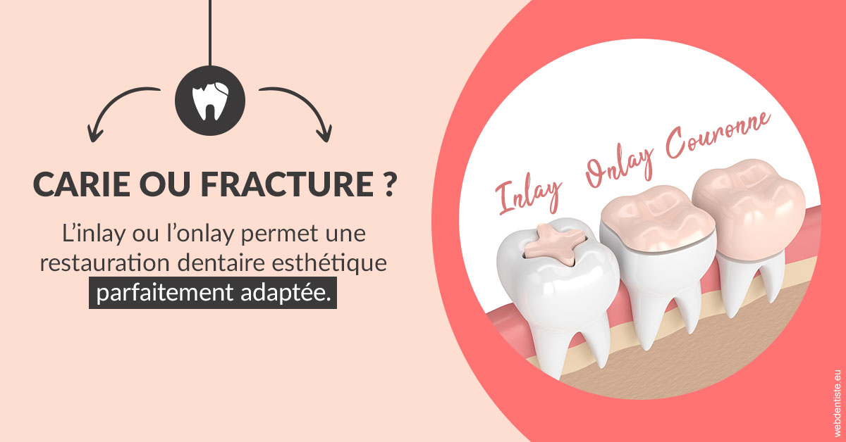 https://www.orthodontiste-charlierlaurent.be/T2 2023 - Carie ou fracture 2