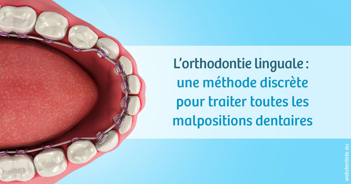 https://www.orthodontiste-charlierlaurent.be/L'orthodontie linguale 1