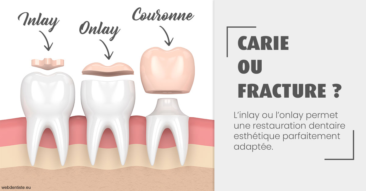 https://www.orthodontiste-charlierlaurent.be/T2 2023 - Carie ou fracture 1