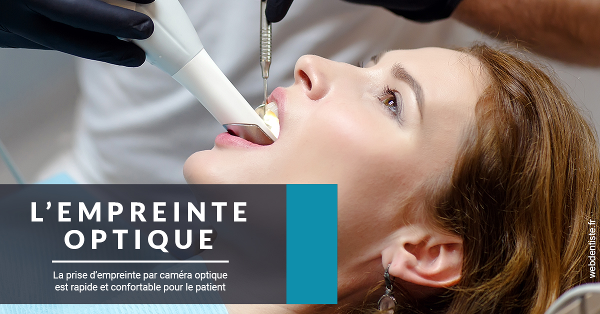 https://www.orthodontiste-charlierlaurent.be/L'empreinte Optique 1