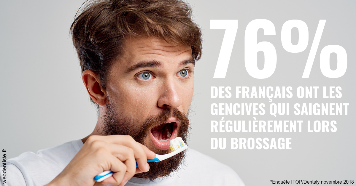 https://www.orthodontiste-charlierlaurent.be/76% des Français 2
