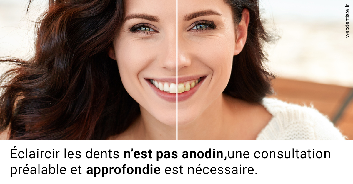 https://www.orthodontiste-charlierlaurent.be/Le blanchiment 2