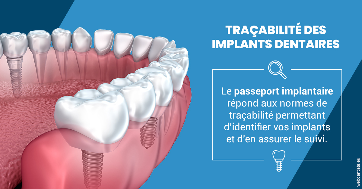 https://www.orthodontiste-charlierlaurent.be/T2 2023 - Traçabilité des implants 1