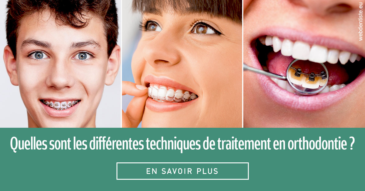 https://www.orthodontiste-charlierlaurent.be/Les différentes techniques de traitement 2