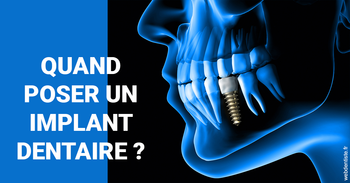 https://www.orthodontiste-charlierlaurent.be/Les implants 1