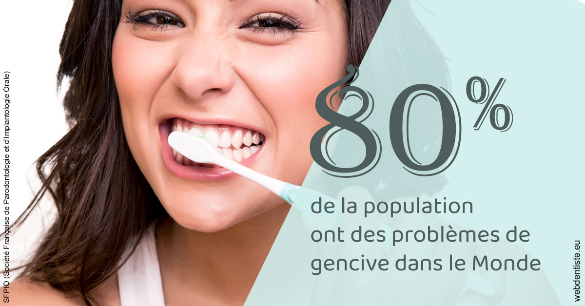 https://www.orthodontiste-charlierlaurent.be/Problèmes de gencive 1