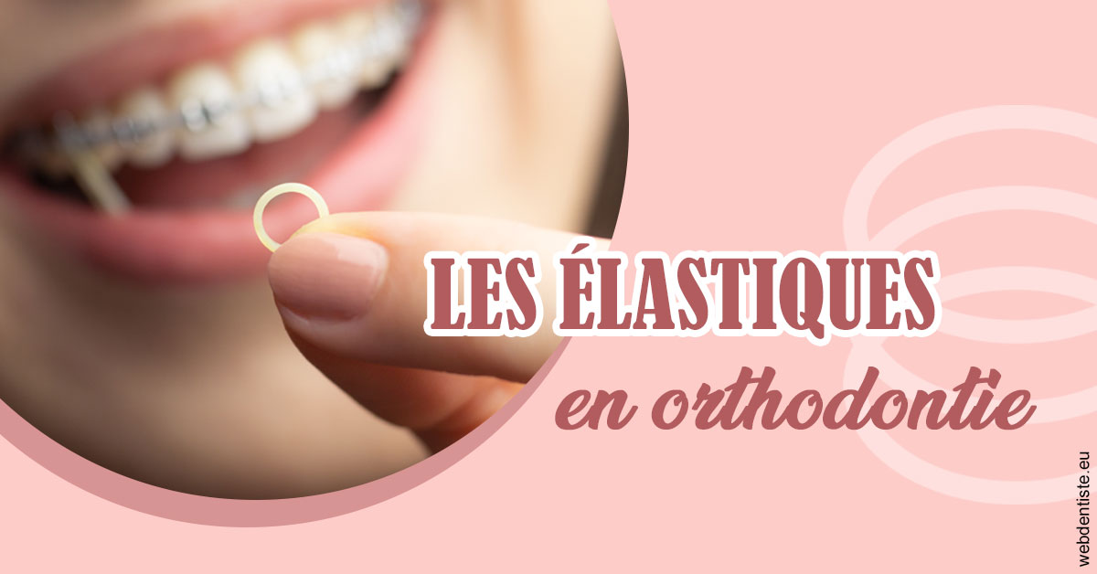 https://www.orthodontiste-charlierlaurent.be/Elastiques orthodontie 1