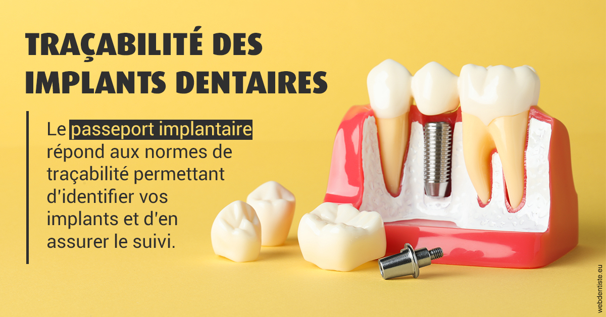https://www.orthodontiste-charlierlaurent.be/T2 2023 - Traçabilité des implants 2