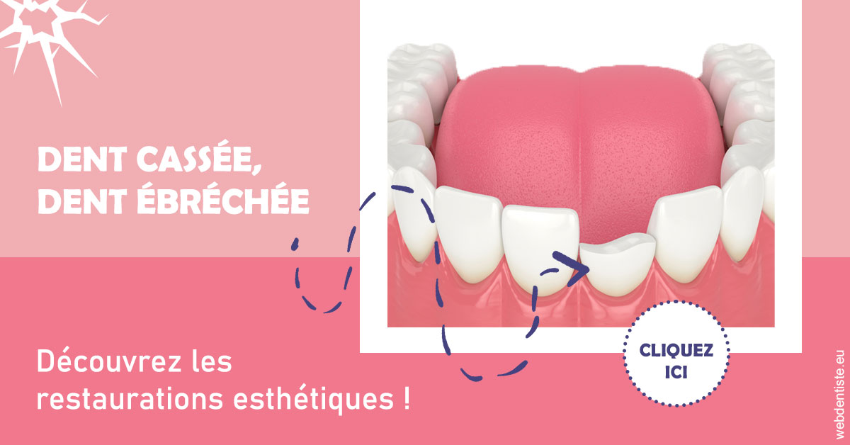 https://www.orthodontiste-charlierlaurent.be/Dent cassée ébréchée 1