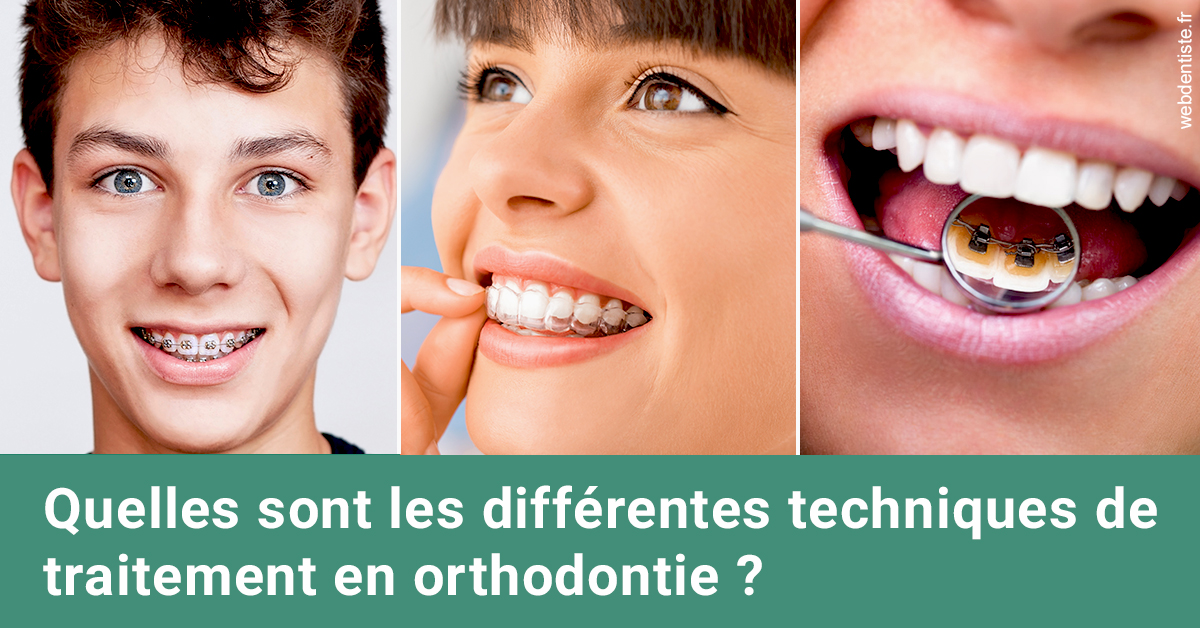 https://www.orthodontiste-charlierlaurent.be/Les différentes techniques de traitement 2