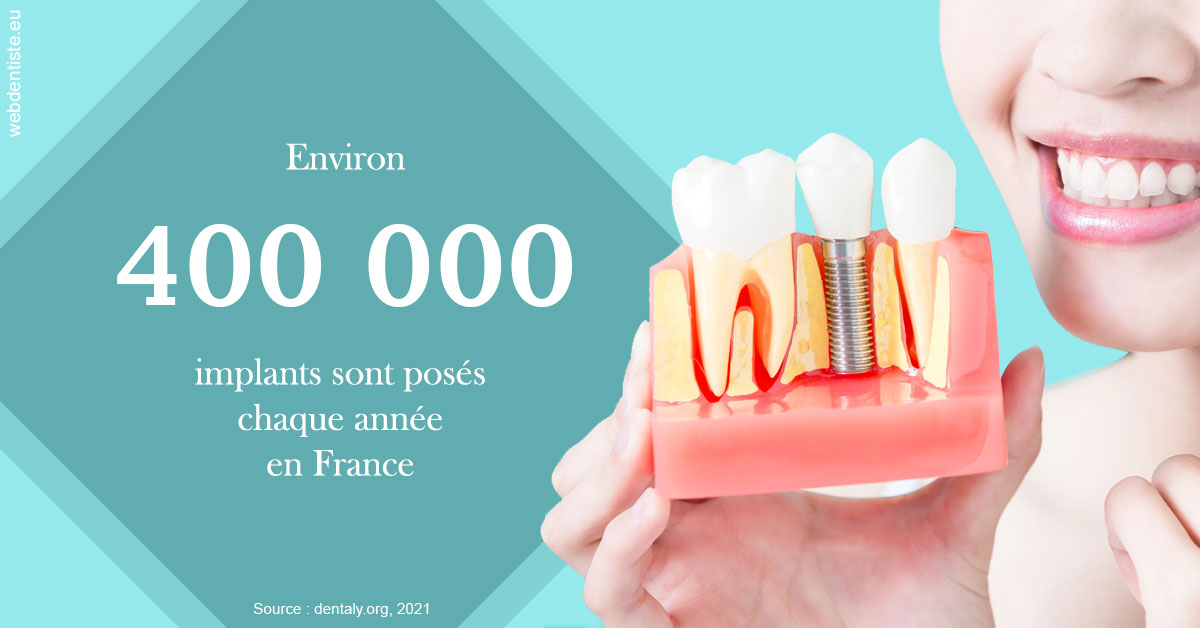https://www.orthodontiste-charlierlaurent.be/Pose d'implants en France 2