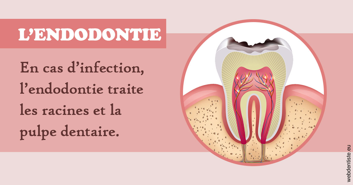 https://www.orthodontiste-charlierlaurent.be/L'endodontie 2