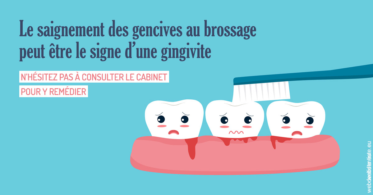 https://www.orthodontiste-charlierlaurent.be/2023 T4 - Saignement des gencives 02